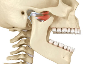 disfunção temporomandibular