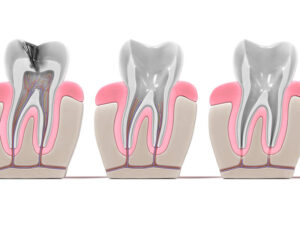 endodontia