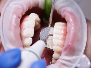 periodontia