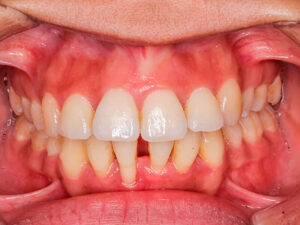 periodontia